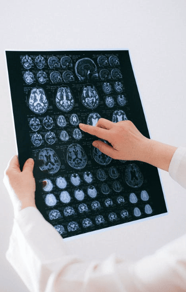 Brain charts showing the effects of heroin on the brain