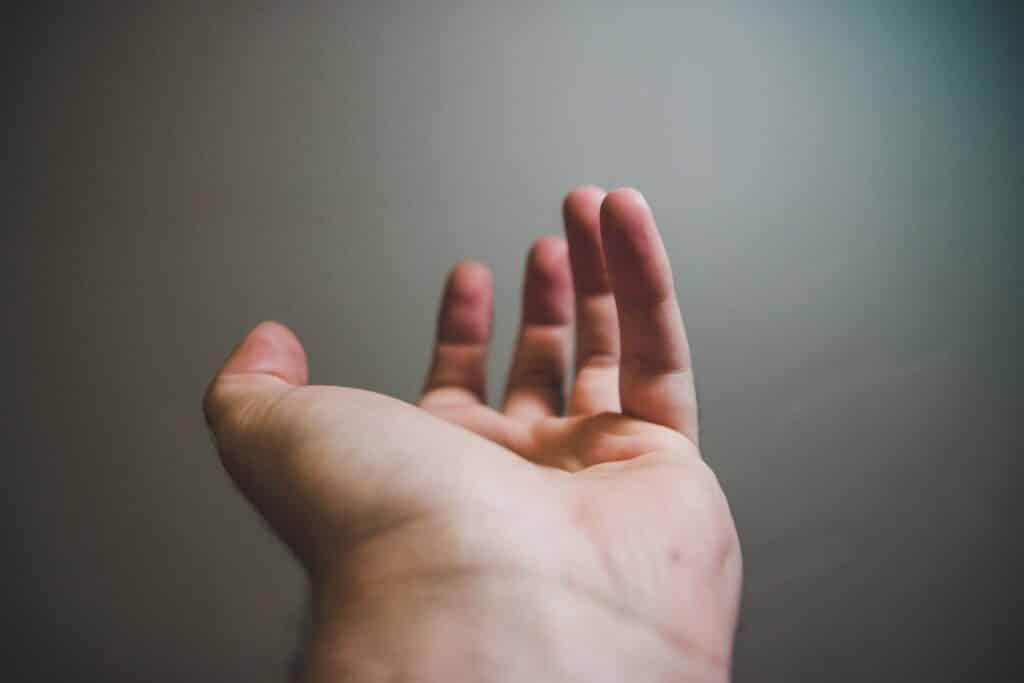 An image of a man with Puffy Hand Syndrome